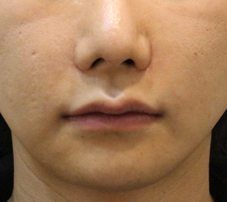 Before Image 4