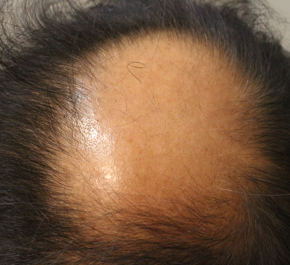 Before Image 3