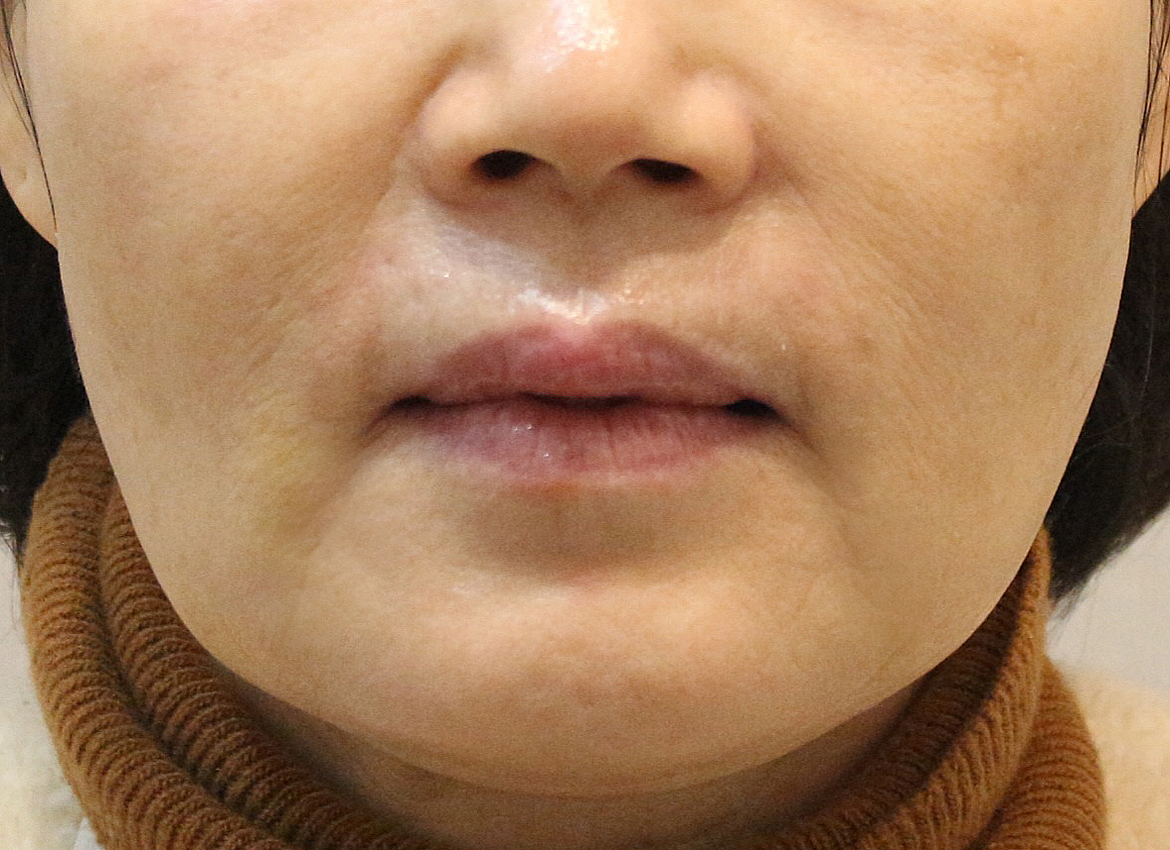 Before Image 4