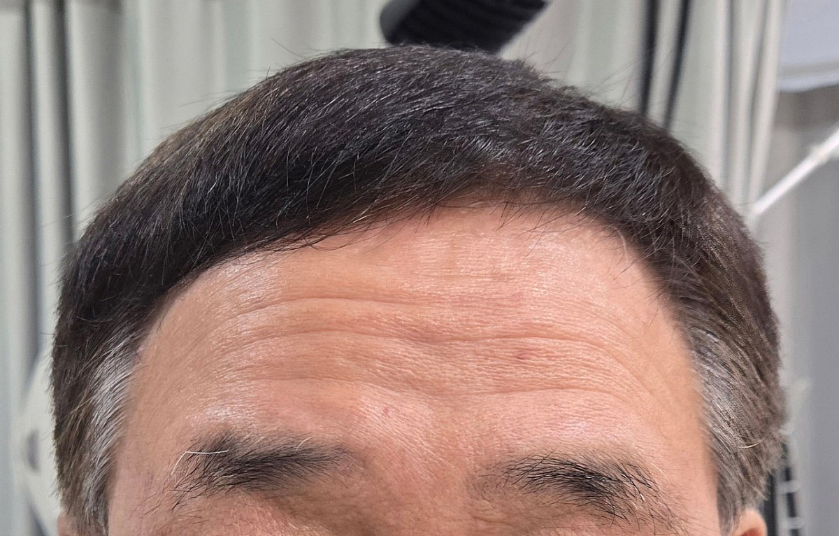 Before Image 4
