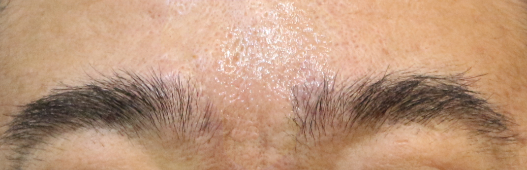 Before Image 4