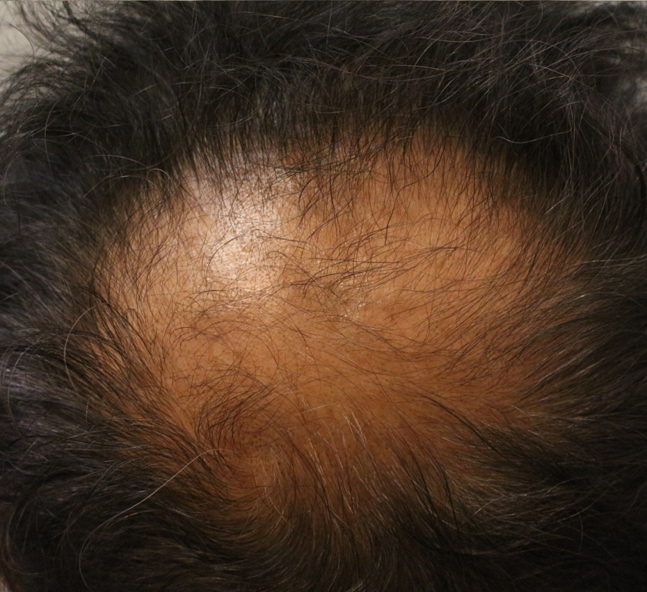 Before Image 4